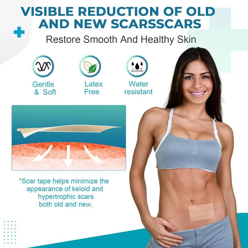 Professional Silicone Scar Sheets Scars Removal Treatment Reusable Silicone Scar Tape Strips Type for Keloid C-Section Surgery